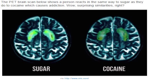 brain-sugar-cocaine