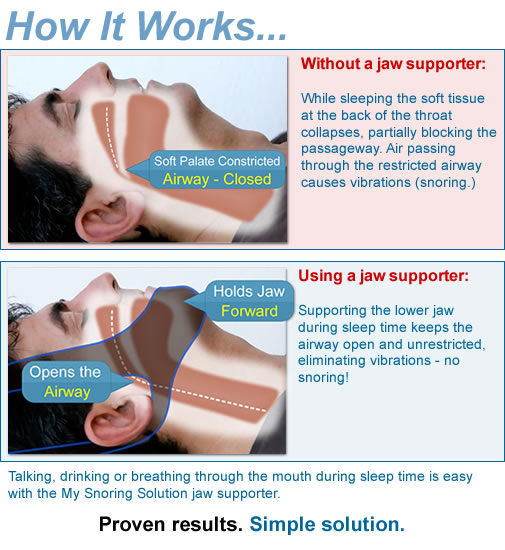 Snoring and Sleep Apnea: The Not So Silent Killer - Factual Facts ...